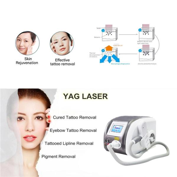 Buy cheap Anybeauty Plus Nd Yag TUV Picosecond Laser Tattoo Removal Machine from wholesalers