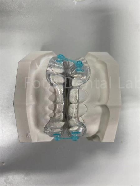 Buy cheap Professional Comfortable Fit Retainer Expander Orthodontic Correction Device from wholesalers