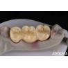 Buy cheap Customizable Dental Implant Supported Bridge And Crown For Dental Implants from wholesalers