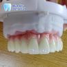 Buy cheap Metal Frame Titanium Malo Bridge Customizable Malo Implant Bridge from wholesalers