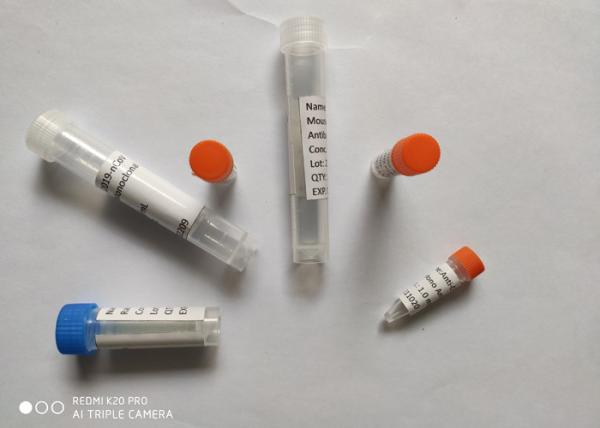 Buy cheap Recombinant COVID-19 Mouse Monoclonal Antibody (Mab) Therapy from wholesalers