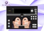 HIFU Beauty Skin Tightening Machine , HIFU Face Lifting Machine 4.0MHz