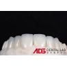 Buy cheap OEM Veneers Dental E-Max Crowns Stain Resistance Minimally Invasive from wholesalers