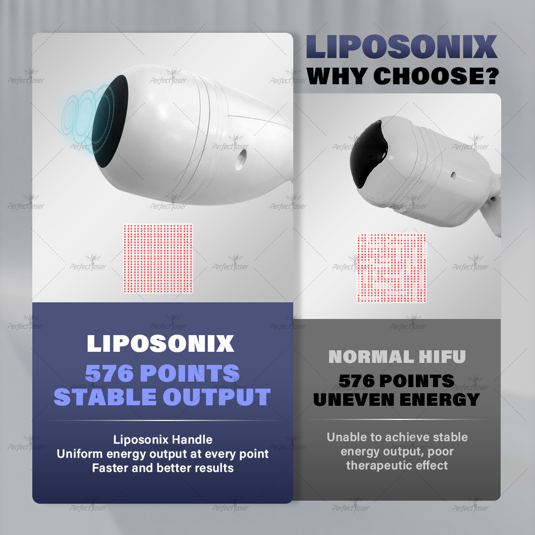 Vmax Energy Levels Vmax Hifu Machine With Vaginal Cartridge Manufactueruer Info