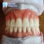 Naturally Full Denture Acrylic Removable Full Dentures Customizable
