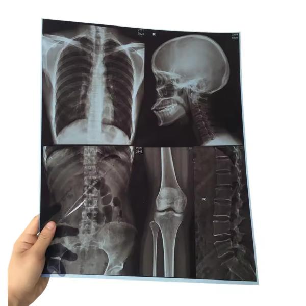 Buy cheap Dry Pix X Ray Film Fuji DIHL X Ray Medical Dry Laser Imaging X Ray Film from wholesalers