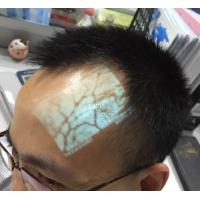 Buy cheap Medical Professional Infrared Vein Viewer Transilluminator Find Veins For product