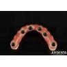 Buy cheap Dental Titanium Malo Implant Bridge Combining Traditional And Modern Techniques from wholesalers