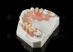 White And Pink Peek Flexible Acrylic Partial Denture With Excellent Resistance