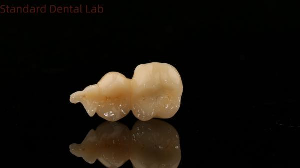 Buy cheap Dental Digital Full Zirconia Crown With 3D Print Model SDL Dental Lab Zirconia Onlay from wholesalers