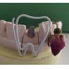 Buy cheap Metal Dental Post And Core After Endodontic Treatment from wholesalers