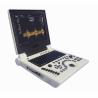 Buy cheap Xianfeng Pregnancy Color Doppler Ultrasound Machines Images 4B OEM from wholesalers