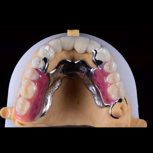 Buy cheap Precision Zirconia PFM Crowns Partial Dentures Natural Looking from wholesalers