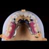 Buy cheap Precision Zirconia PFM Crowns Partial Dentures Natural Looking from wholesalers