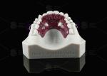 Habbit Orthodontic Tongue Crib Appliance Customizable Dental Crib Appliance