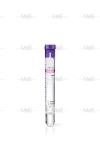 Buy cheap Adjustable Centrifugal SST Blood Test Tube For PRP Separation from wholesalers