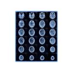 Blue Inkjet Film For Medical Xray Graphic Printing
