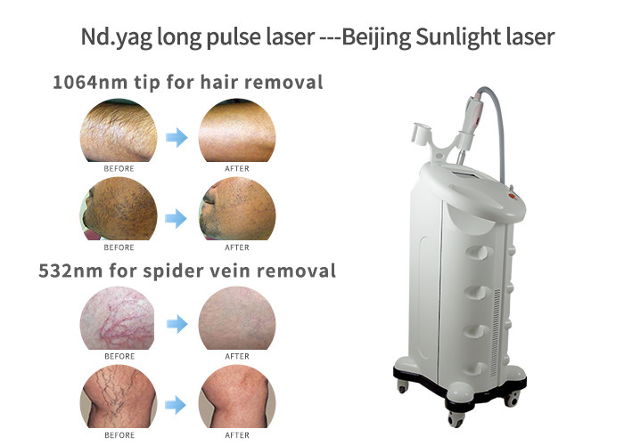 1064nm Nd Yag Laser Hair Removal Machine For Dark Skin Type VI / VII 70 * 53 * 101cm