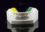 Colorful Gelb Dental Splint Hard Acrylic Resin Occlusal Splint For Nighttime