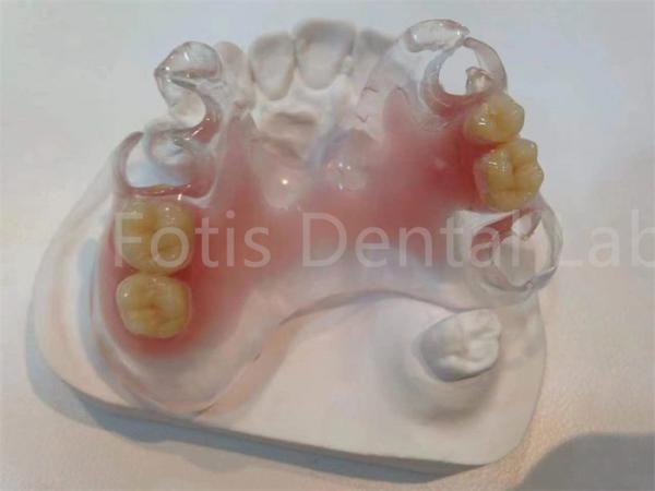 Hypoallergenic Stain Resistant TCS Valplast Dental Prosthetics For Long Lasting
