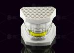 Acrylic Orthodontic Bionator Appliance Corrects Class II Malocclusion