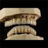 Buy cheap Cad Cam Implant PFM Crown Bridge Dental Medical Grade Adhesive from wholesalers