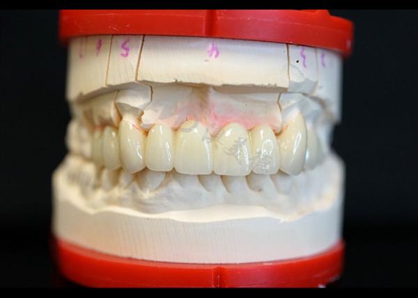 Buy cheap Strength Natural Esthetics Solid Zirconia Crown Perfect Fit for Single or Multiple Teeth from wholesalers