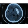 Buy cheap Medical Dry Thermal PET X Ray Film , Agfa Drystar DT2B Fuji Drypix from wholesalers