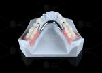 Sleek Precision ERA Dental Attachments For Universal Secure Dental Prosthetics