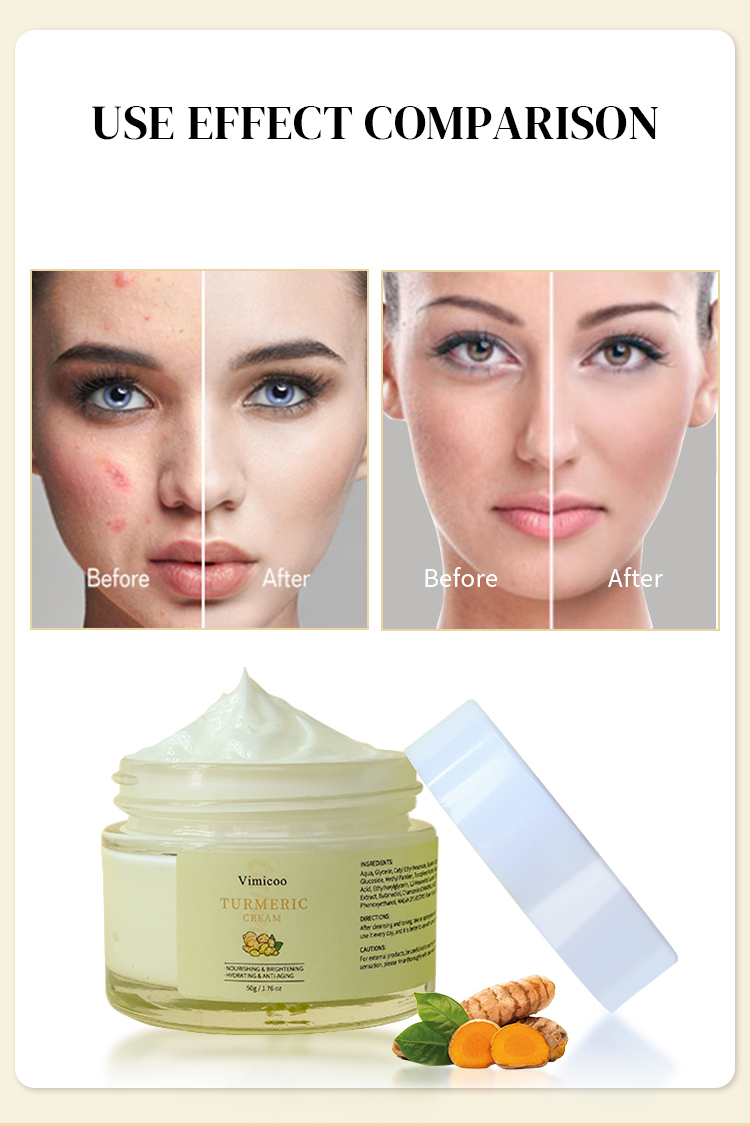 Beauty Skin Care Private Label Natural Organic Repairing Moisturizer Tumeric Turmeric Facial Cream for Face