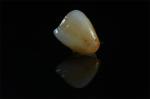 Buy cheap Premium Zirconia Crowns with Natural-Looking Stain - China Dental Manufacturer from wholesalers