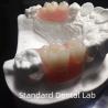 Buy cheap Flexible Clear Metal Cast Framework Partial Dentures High Esthetics Perfect Fit from wholesalers