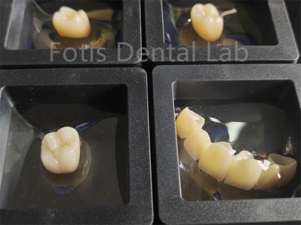 Buy cheap Dental Restorations Zirconia Multilayer Fracture Resistance from wholesalers