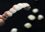Buy cheap Aesthetic Solution Dental Implant Crown Bridge For Adults Replacing Missing Teeth from wholesalers