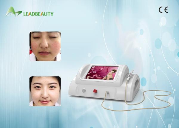 Buy cheap Non-Invasive Treatment Spider Vein Removal Machine 30mhz High Frequency from wholesalers