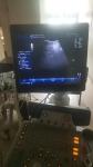 GE original imaging ultrasound machine Logiq P6