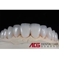 Buy cheap Dental Porcelain Emax Laminate Veneers Seamlessly Customized product