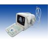 Buy cheap Portable Pregnancy Ultrasound Scanner with Abdominal Convex Transvaginal Transducers from wholesalers
