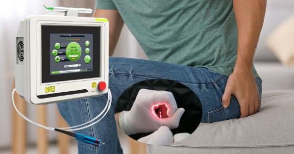 Buy cheap ISO9001 Professional Laser Machine For Hemorrhoids 15J 9W from wholesalers