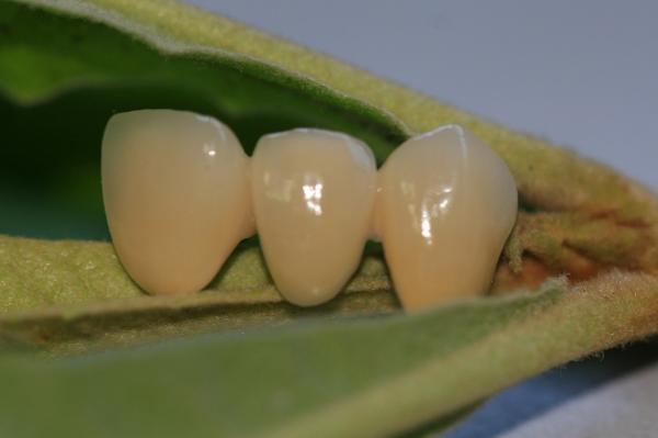 Buy cheap ISO13485 Good Biocompatibility PFM Non Precious Dental Crown from wholesalers