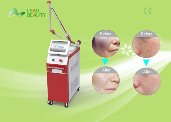Buy cheap Newest Tattoo laser q-switch ND yag laser tattoo removal machine from wholesalers