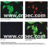 Buy cheap Infinity Plan LED Fluorescence Microscope 100X - 1000X A16.0907-BL from wholesalers