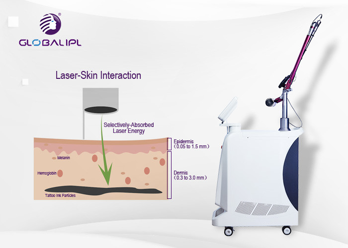 4 Handpieces Portable Laser Tattoo Removal Machine With 1 - 6hz Frequency