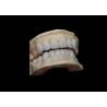 Buy cheap Porcelain EMAX Veneer High Precision Esthetic Restorations with Superior Durability from wholesalers