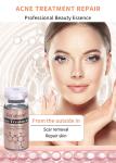 Luxurious 24k Hyaluronic Acid Meso Serum Set Lightweight Texture Acne Treatment