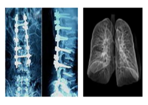 Buy cheap Sharp Radiographic Medical X Ray Films , Mri Dr Ct Digital Dry Imaging Film from wholesalers