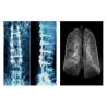 Buy cheap Sharp Radiographic Medical X Ray Films , Mri Dr Ct Digital Dry Imaging Film from wholesalers