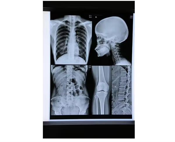Buy cheap Blue Inkjet Medical X Ray Film Medical Dry Film A4 Sheet Or In Roll No Reviews Yet from wholesalers