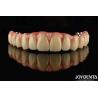 Buy cheap Comfortable Wear Titanium Malong Hybrid Bridge Dental Adjustable Design Light Weight from wholesalers