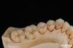 3D Multi Layer Dental Full Zirconia Chipping Resistance Natural Tooth Structure